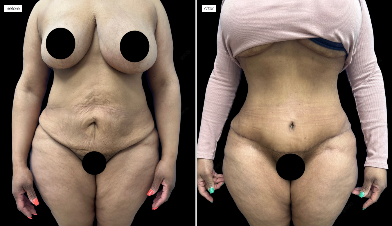 01-Body-Contouring.png