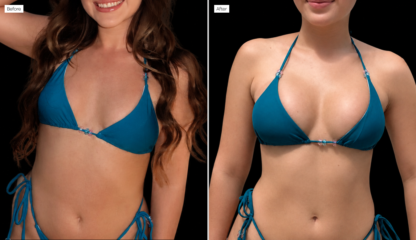 2-Breast.png